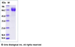 Sino Biological Recombinant Cynomolgus IL-4R Protein (ECD, hFc Tag), HPLC-verified,