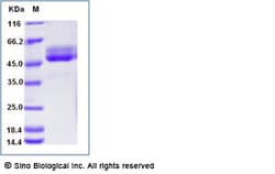 Sino Biological Recombinant Cynomolgus TIGIT Protein (ECD, hFc Tag), Quantity: