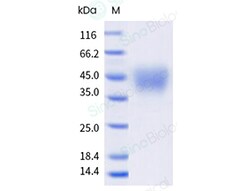Sino Biological Recombinant Cynomolgus, Rhesus CD47 Protein (ECD, His Tag),