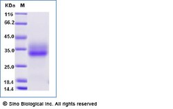 Sino Biological Recombinant Cynomolgus, Rhesus 4-1BB/CD137 Protein (His