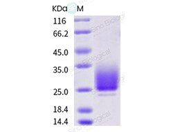 Sino Biological Recombinant Cynomolgus CD147/Basigin/EMMPRIN Protein (His