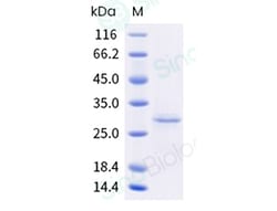 Sino Biological Recombinant ASFV P72-C protein, Quantity: Each of 1