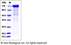 Sino Biological Recombinant Rhesus gp130/IL6ST Protein (hFc Tag), HPLC-verified,
