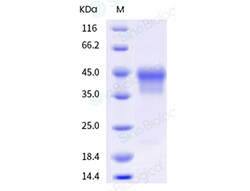 Sino Biological Recombinant Rhesus CD25/IL-2R alpha Protein (ECD, His &