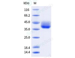 Sino Biological Recombinant Cynomolgus, Rhesus PD-L1/B7-H1 Protein (His