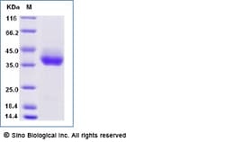 Sino Biological Cynomolgus / Rhesus PD-L1 / B7-H1 / CD274 Protein (His