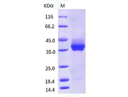 Sino Biological Cynomolgus / Rhesus PD-L1 / B7-H1 / CD274 Protein (His