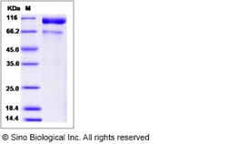 Sino Biological Recombinant Rhesus ACE2 Protein (His Tag), HPLC-verified,