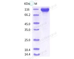 Sino Biological Recombinant Rhesus ACE2 Protein (hFc Tag), Quantity: Each
