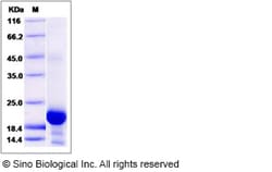 Sino Biological Recombinant Cynomolgus, Rhesus IL-6 Protein, Quantity: