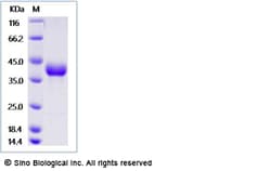 Sino Biological Recombinant Cynomolgus CD52 Protein (hFc Tag), Quantity: