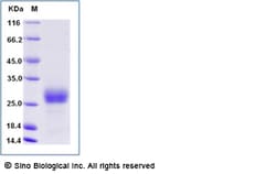 Sino Biological Recombinant Cynomolgus HVEM Protein (His Tag), Quantity: