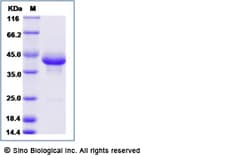 Sino Biological Recombinant Cynomolgus, Rhesus BCMA Protein (AVI & Fc Tag),