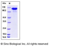 Sino Biological Recombinant Rhesus HER3/ERBB3 Protein (His Tag), HPLC-verified,