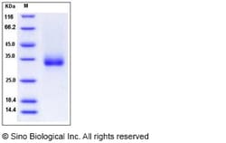 Sino Biological Recombinant Cynomolgus CD32B/Fcgr2b Protein (His & AVI