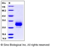 Sino Biological Recombinant Cynomolgus CD32B/Fcgr2b Protein (His Tag),