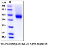 Sino Biological Recombinant Rhesus CD16/FCGR3/Fc gamma RIII Protein (His