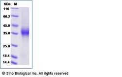 Sino Biological Recombinant Cynomolgus CD16a/FCGR3A/Fc gamma RIIIA Protein