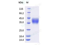 Sino Biological Recombinant Rhesus CD16/FCGR3/Fc gamma RIII Protein (His