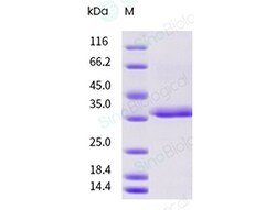 Sino Biological Recombinant Rat FGL1 Protein (His Tag), Quantity: Each