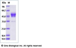 Sino Biological Recombinant Rat TIGIT Protein (hFc Tag), HPLC-verified,