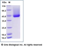 Sino Biological Recombinant Rat Decorin Protein (His Tag), Quantity: Each