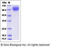 Sino Biological Recombinant Rat TrkA Protein (His Tag), HPLC-verified,