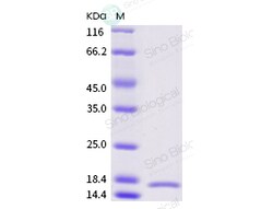 Sino Biological Recombinant Rat IL-1 alpha/IL1A Protein, Quantity: Each