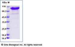 Sino Biological Recombinant Rat TPO-R Protein (ECD, hFc Tag), Quantity: