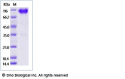 Sino Biological Recombinant Rat SIRP alpha/SHPS-1 Protein (ECD, hFc Tag),