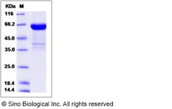 Sino Biological Recombinant Rat CD23 Protein (hFc Tag), Quantity: Each