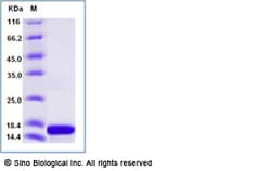 Sino Biological Recombinant Rat IL-21 Protein, Quantity: Each of 1