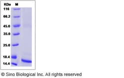 Sino Biological TGF beta 1 Protein, Rat/Mouse, Recombinant, Quantity: Each