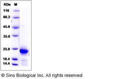 Sino Biological Recombinant Rat IL-6 Protein, Quantity: Each of 1