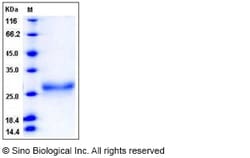 Sino Biological Recombinant Rat Erythropoietin/EPO Protein (His Tag), Quantity: