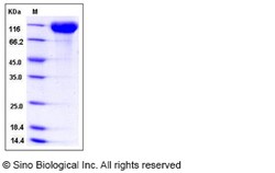Sino Biological Recombinant Rat ACE2 Protein (His Tag), Quantity: Each