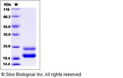 Sino Biological Recombinant Rat GM-CSF/CSF2 Protein (His Tag), Quantity: