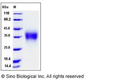 Sino Biological Recombinant Rat CD32B/Fcgr2b Protein (His Tag), Quantity: