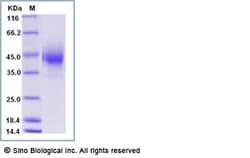 Sino Biological Recombinant Rat CD32A/FCGR2A Protein (His Tag), Quantity: