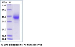 Sino Biological Recombinant Rat CD32A/FCGR2A Protein (His Tag), Quantity: