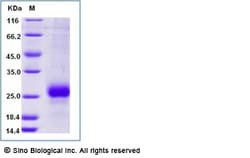 Sino Biological Recombinant Canine Can f 2 Protein (His Tag), Quantity:
