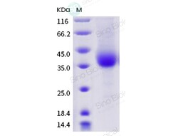 Sino Biological Recombinant Canine PD-1 Protein (His & AVI Tag), Biotinylated,