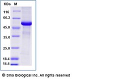 Sino Biological Recombinant Canine IL-25/IL-17E Protein (hFc Tag), Quantity: