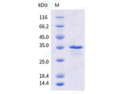 Sino Biological Plasmodium falciparum (strain 3D7) CSP Protein (His & GST
