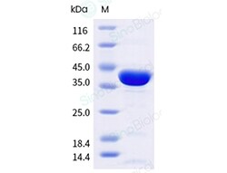 Sino Biological E. coli Maltose Binding Protein (His Tag), HPLC-verified,