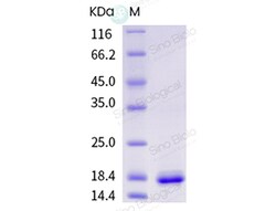 Sino Biological Recombinant Corylus avellana Cor a 1 Protein, Quantity: