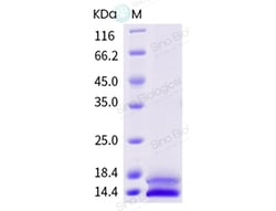Sino Biological Recombinant Phleum pratense Phl p 2 Protein (His Tag),