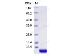 Sino Biological Recombinant Betula pendula Bet v 4 Protein (His Tag), Quantity:
