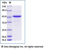 Sino Biological Recombinant Neosartorya fumigata Asp f 9 Protein (His Tag),