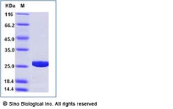 Sino Biological Recombinant Neosartorya fumigata Asp f 6 Protein (His Tag),
